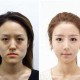 地包天女人面相 地包天的女人命运好不好