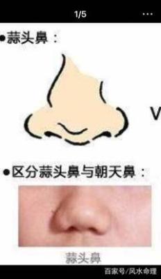 蒜头鼻面相怎么样?蒜头鼻面相人命运