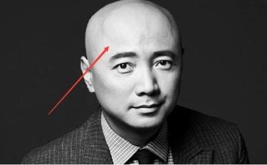 有智慧的人面相怎么看头脑聪明想法多