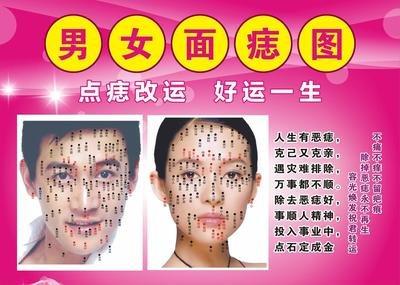 脸上痣的位置影响运势 什么地方长痣不好