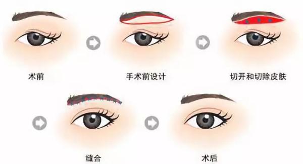额头高的女生命运如何 分析额头高女人的命运