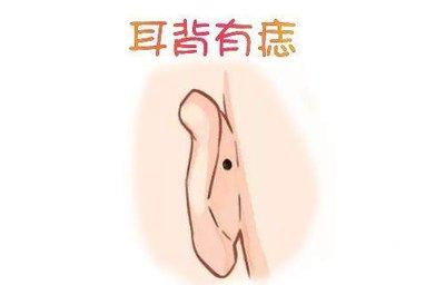 耳朵有痣命运好不好 耳朵长痣说明了什么