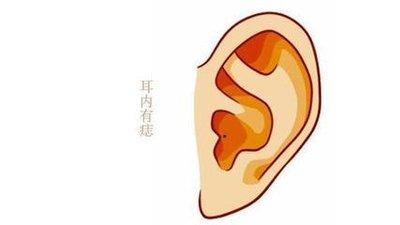 耳朵背后长痣面相图解 耳朵背后长痣财运好?