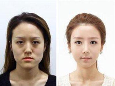 地包天女人面相 地包天的女人命运好不好