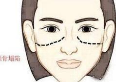 对感情忠诚专一的女人都有哪些面相特征可以娶